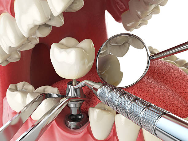 Best Pediatric Emergency Dentist in Oswego, IL
